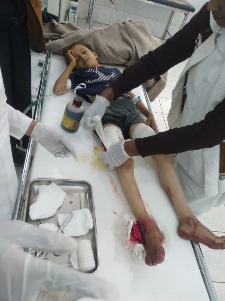 إصابة 6 أطفال وامرأة جراء قصف ميليشيا الحوثي لمخيم “الحمة” للنازحين جنوبي مأرب