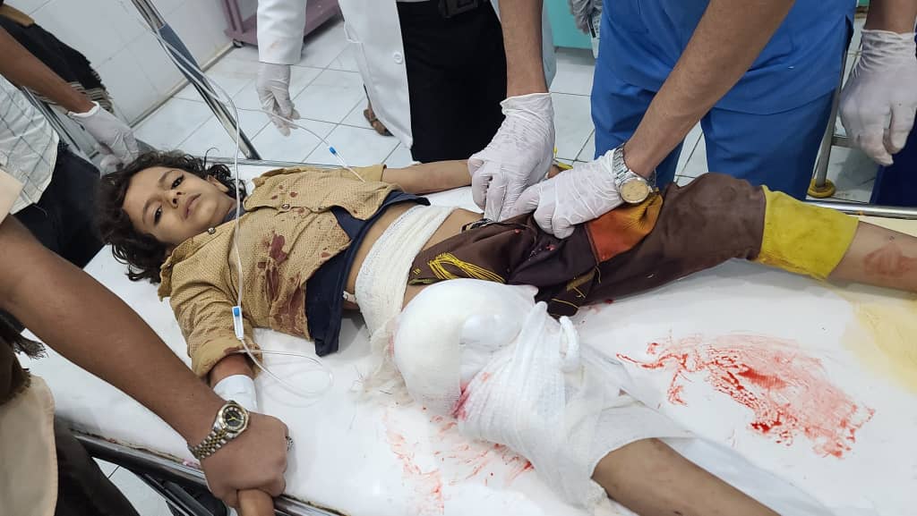 مقتل واصابة 28 مدنياً في قصف حوثي استهدف حياً سكنياً بمدينة مأرب